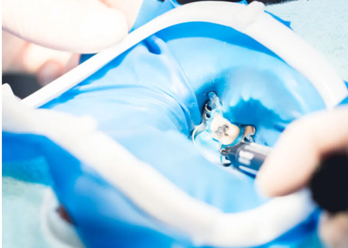 一般歯科の画像